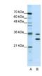 Methenyltetrahydrofolate Synthetase Domain Containing antibody, NBP1-80462, Novus Biologicals, Western Blot image 