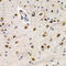 Id-3 antibody, LS-C346080, Lifespan Biosciences, Immunohistochemistry frozen image 