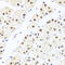 RAB3A Interacting Protein antibody, 23-396, ProSci, Immunohistochemistry paraffin image 