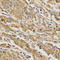 BAI1 Associated Protein 2 antibody, A03306, Boster Biological Technology, Immunohistochemistry paraffin image 
