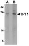 Tumor Protein, Translationally-Controlled 1 antibody, LS-B10074, Lifespan Biosciences, Western Blot image 