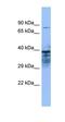 Zinc Finger MYND-Type Containing 15 antibody, orb326827, Biorbyt, Western Blot image 