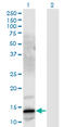 Gastrin Releasing Peptide antibody, LS-C197364, Lifespan Biosciences, Western Blot image 