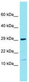 Family With Sequence Similarity 177 Member B antibody, TA335327, Origene, Western Blot image 