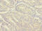 MORN Repeat Containing 5 antibody, CSB-PA736208LA01HU, Cusabio, Immunohistochemistry paraffin image 