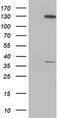 PIH1 Domain Containing 2 antibody, MA5-25429, Invitrogen Antibodies, Western Blot image 