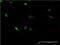Zinc Finger Protein 76 antibody, H00007629-M06, Novus Biologicals, Immunofluorescence image 