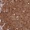 Zinc Finger Protein 619 antibody, NBP1-92636, Novus Biologicals, Immunohistochemistry frozen image 