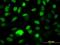 NIPP1 antibody, H00005511-M21, Novus Biologicals, Immunocytochemistry image 