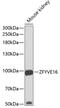 Zinc Finger FYVE-Type Containing 16 antibody, 23-168, ProSci, Western Blot image 