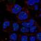 Zinc Ribbon Domain Containing 1 antibody, NBP2-69057, Novus Biologicals, Immunocytochemistry image 