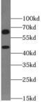 Solute carrier family 2, facilitated glucose transporter member 2 antibody, FNab03501, FineTest, Western Blot image 