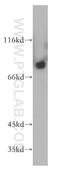 Neuronal Guanine Nucleotide Exchange Factor antibody, 13271-1-AP, Proteintech Group, Western Blot image 