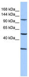 Stromal Antigen 3 antibody, TA335651, Origene, Western Blot image 