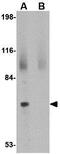 Junctophilin 2 antibody, GTX85367, GeneTex, Western Blot image 