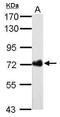 Urease B antibody, MA5-16310, Invitrogen Antibodies, Western Blot image 