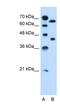 OATP antibody, NBP1-59658, Novus Biologicals, Western Blot image 