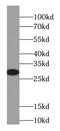 HGb antibody, FNab02189, FineTest, Western Blot image 