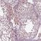 Cell Division Cycle 14A antibody, NBP1-84573, Novus Biologicals, Immunohistochemistry paraffin image 