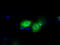 3-Hydroxybutyrate Dehydrogenase 2 antibody, TA501293, Origene, Immunofluorescence image 