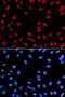 Gamma-interferon-inducible protein 16 antibody, LS-C331821, Lifespan Biosciences, Immunofluorescence image 