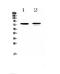 Frizzled Class Receptor 3 antibody, PA5-79289, Invitrogen Antibodies, Western Blot image 