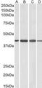 ArfGAP With Dual PH Domains 1 antibody, GTX89614, GeneTex, Western Blot image 