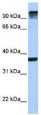 Epidermal Growth Factor Receptor Pathway Substrate 15 antibody, TA335021, Origene, Western Blot image 