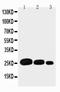 Adiponectin, C1Q And Collagen Domain Containing antibody, PA2014-1, Boster Biological Technology, Western Blot image 