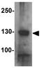 Ring Finger And CCCH-Type Domains 1 antibody, GTX31528, GeneTex, Western Blot image 