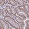 Mitochondrial Calcium Uptake 2 antibody, PA5-61023, Invitrogen Antibodies, Immunohistochemistry frozen image 
