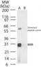 Ankyrin-like protein antibody, PA1-41504, Invitrogen Antibodies, Western Blot image 