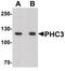PH3 antibody, PA5-38047, Invitrogen Antibodies, Western Blot image 