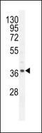 NADH:Ubiquinone Oxidoreductase Complex Assembly Factor 3 antibody, LS-C164796, Lifespan Biosciences, Western Blot image 