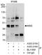 Musashi RNA Binding Protein 2 antibody, A303-215A, Bethyl Labs, Immunoprecipitation image 