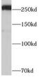 ATP Binding Cassette Subfamily A Member 4 antibody, FNab09922, FineTest, Western Blot image 