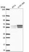Nucleosome Assembly Protein 1 Like 2 antibody, NBP2-58252, Novus Biologicals, Western Blot image 