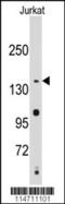 Structural maintenance of chromosomes protein 2 antibody, 61-428, ProSci, Western Blot image 