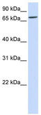 Interleukin 1 Receptor Accessory Protein Like 2 antibody, TA342027, Origene, Western Blot image 