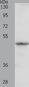 Rho GDP-dissociation inhibitor 1 antibody, TA323162, Origene, Western Blot image 