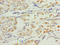 SMG6 Nonsense Mediated MRNA Decay Factor antibody, LS-C398998, Lifespan Biosciences, Immunohistochemistry paraffin image 