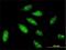 E3 ubiquitin-protein ligase TRIM56 antibody, H00081844-M01, Novus Biologicals, Immunofluorescence image 