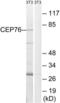 Centrosomal Protein 76 antibody, LS-C119836, Lifespan Biosciences, Western Blot image 