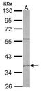 Replication Factor C Subunit 4 antibody, GTX104052, GeneTex, Western Blot image 