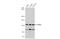 Ubiquitin carboxyl-terminal hydrolase 8 antibody, GTX103747, GeneTex, Western Blot image 