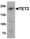 Methylcytosine dioxygenase TET2 antibody, PA5-72804, Invitrogen Antibodies, Western Blot image 