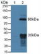 Neurotrophic Receptor Tyrosine Kinase 2 antibody, LS-C374361, Lifespan Biosciences, Western Blot image 