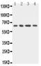 Plasminogen Activator, Urokinase Receptor antibody, PA1344, Boster Biological Technology, Western Blot image 