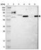 Malic Enzyme 1 antibody, NBP1-86129, Novus Biologicals, Western Blot image 