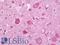 Plexin C1 antibody, LS-B10991, Lifespan Biosciences, Immunohistochemistry frozen image 